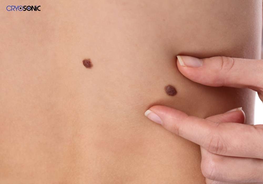 Infection Risk and Poor Aftercare Gosport