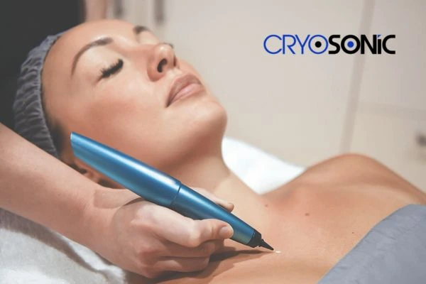 Cryosonic lesion removal prices book today! Gosport