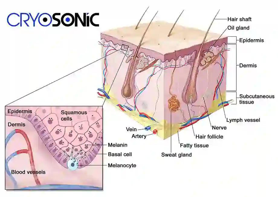 How Cryotherapy Stimulates Melanocyte Activity  Gosport